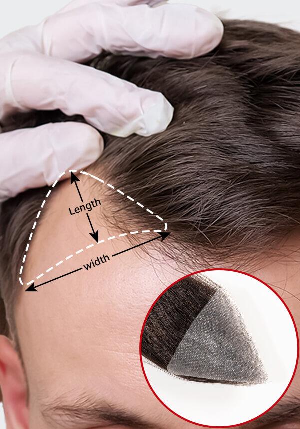 Small Forehead Hairpiece Toupee Human Hair Frontal Remy Hair Patch for Men (2 Pieces)