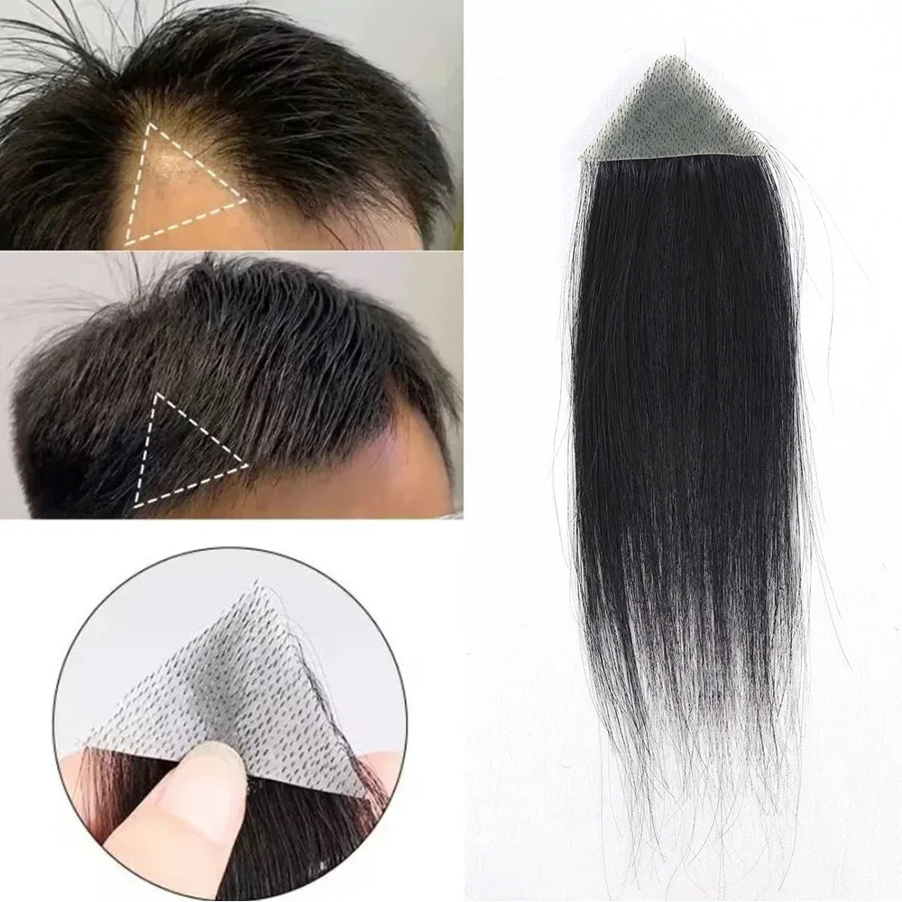 Small Forehead Hairpiece Toupee Human Hair Frontal Remy Hair Patch for Men (2 Pieces)