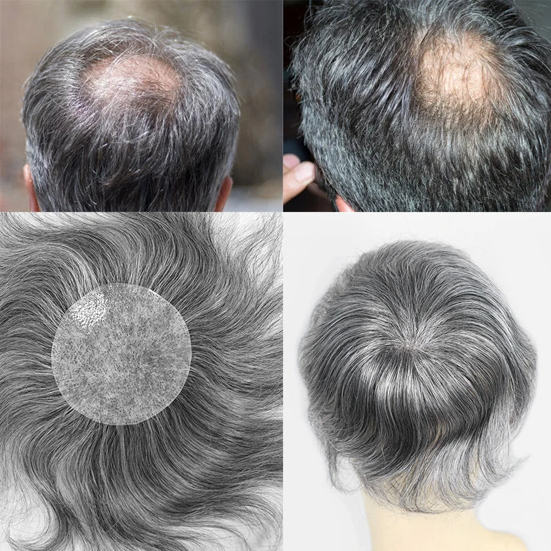 Side or Back Hair Patches for Men, Hairpiece for Men, Cover Bald Spot On Head, Thin Skin, Toupee Patch, 8 x 8 cm
