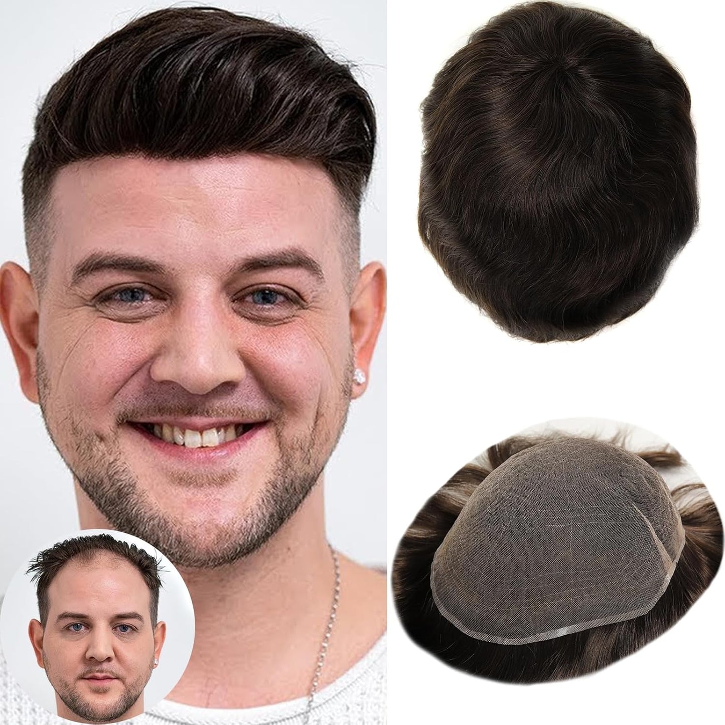 Real Skinlike HD Lace Toupee Hair for Men | 8x10 Inch Ultra  Lace Base Hairpieces