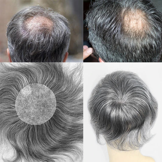 Side or Back Hair Patches for Men, Hairpiece for Men, Cover Bald Spot On Head, Thin Skin, Toupee Patch, 8 x 8 cm